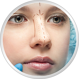 rinoplastika